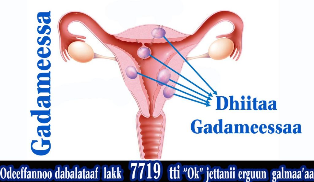 Dhiita Gadameessaa